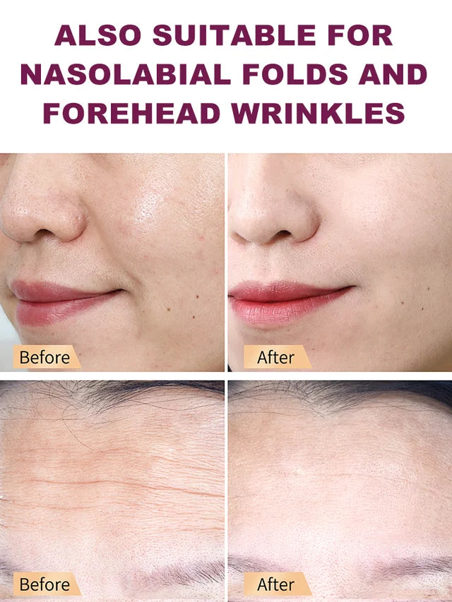 Wrinkle-lightening and firming eye cream stick💦