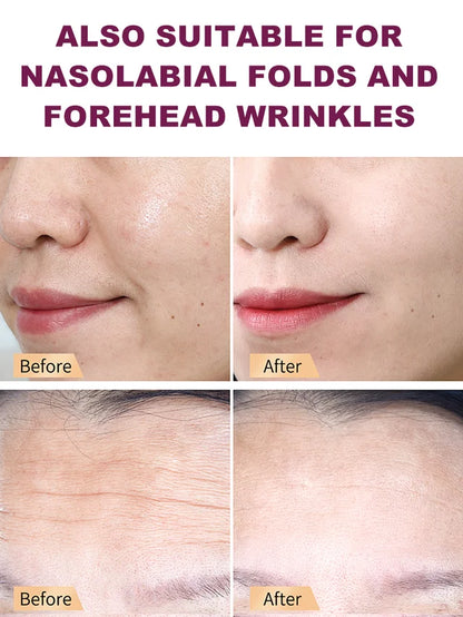 Wrinkle-lightening and firming eye cream stick💦