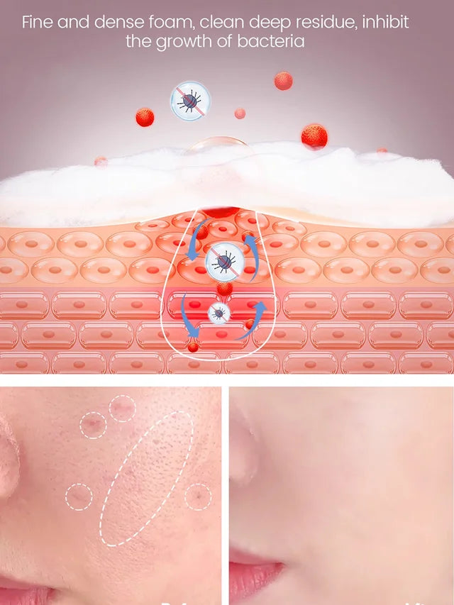 [Washes away 99.9% of dust mites] Salicylic acid soap🧼