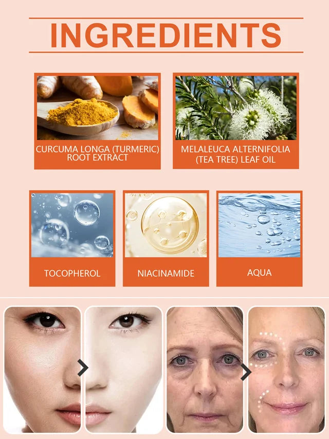 Turmeric Moisturizing Cream💦