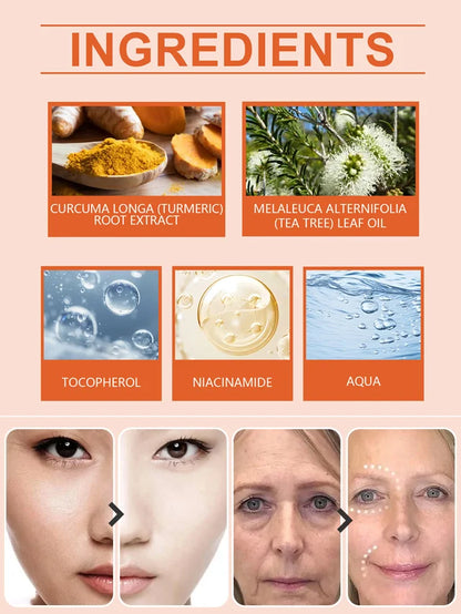 Turmeric Moisturizing Cream💦