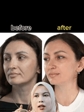 Turmeric Moisturizing Cream💦