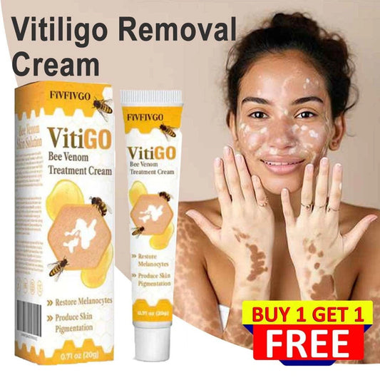 Vitiligo Removal Cream💦
